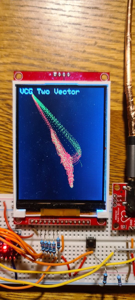NeilGrubb's tweet image. First working version of home built VCG (vectorcardiograph) - it works! Two ECG bipoles (L-R and A-P). First VCG acquisition shown...
#arduino #arduinoproject #adafruit #electronicsprojects #EKG #vectorcardiography #epeeps #medicaldevices #arrhythmia #CardioTwitter #cardiology