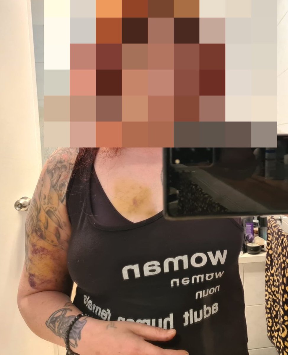 Oli London tweet media