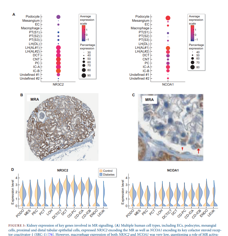 Mineralocorticoid receptor antagonists for nephroprotection and cardioprotection in patients with diabetes mellitus and chronic kidney disease
📖bit.ly/3mYIP6x
📸Potential mechanisms of action of MRAs on DKD and key differences between MRAs