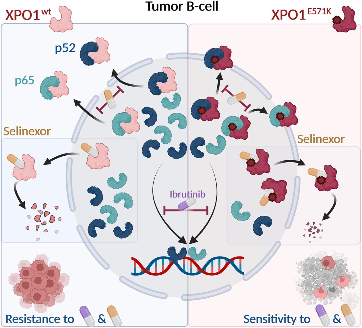 MolOncology's tweet photo. Now available to read in Early View
Exportin 1-mediated nuclear/cytoplasmic trafficking controls drug sensitivity of classical Hodgkin's lymphoma
🔓https://t.co/z2rLcPi6eL
#HaematologicalMalignancy
#HemOnc #Exportin #Caxtx https://t.co/LoaewcQxsq