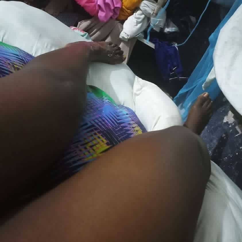 LoisAdeniji's tweet photo. Please I need your help!

My friend (@conflict_chick) had hip replacement surgery some weeks ago and right now, for the next 6 months she has to undergo physiotherapy sessions 3 times a week. She is in so much pain and we’ve exhausted everything we have on the surgery. https://t.co/QhSuDtuipN