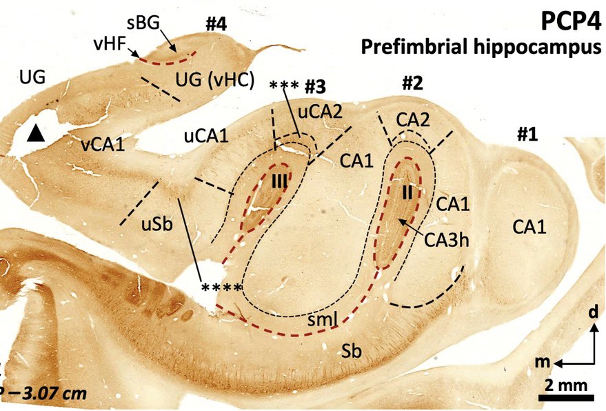 LMPrida's tweet image. See our new preprint 📝! In collaboration with Carmen Cavada, we performed an histochemical segmentation of the human hippocampus along the longitudinal axis using Rph3a, PCP4, Chromogranin A and RGS-14 immunostaining. researchsquare.com/article/rs-282… 
Much more coming soon!!
