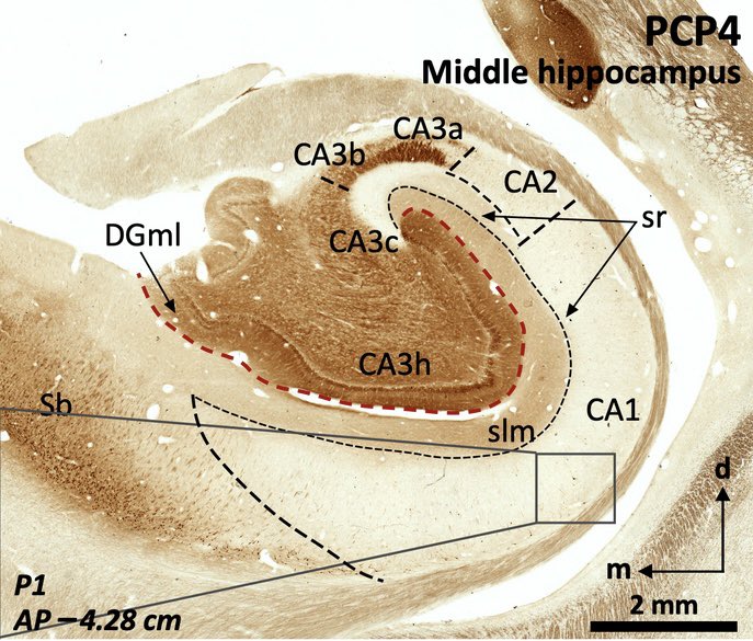 LMPrida's tweet image. See our new preprint 📝! In collaboration with Carmen Cavada, we performed an histochemical segmentation of the human hippocampus along the longitudinal axis using Rph3a, PCP4, Chromogranin A and RGS-14 immunostaining. researchsquare.com/article/rs-282… 
Much more coming soon!!