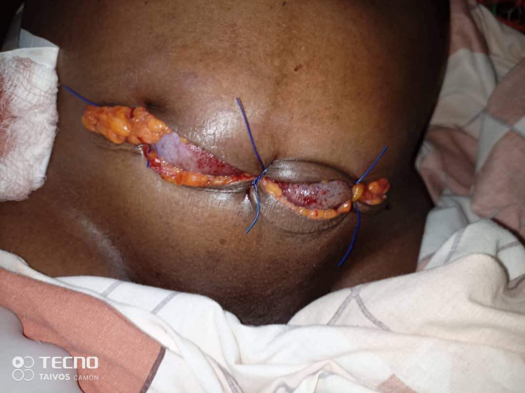 KakwenzaRukira's tweet photo. A few weeks ago, a good doctor at the health centre in Mukono could only do this. Mukono had no supplies. The doctor improvised before referring the patient. To those posting buildings, cut the crap. Demand that our hospitals are well equipped. #UgandaHealthExhibition https://t.co/es9f1Uc3SQ