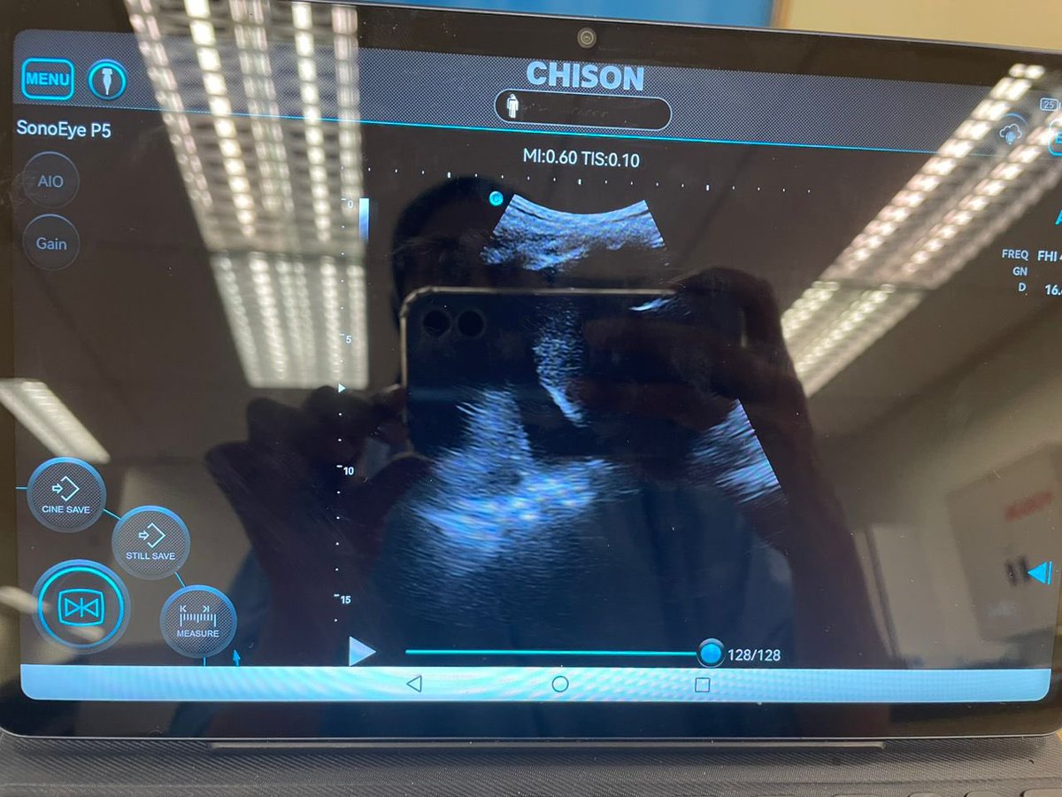 Aegan6's tweet photo. When its your 3rd back to back oncall.. and your ultrasound probe shows you something you dont want to see🤪🤪🤪 https://t.co/yMMjVzhRLX