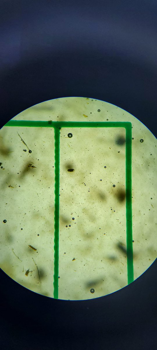 Cliffefarmvets's tweet photo. ⚠️ NEMATODIRUS WARNING ⚠️ The risk in Sussex is currently high: https://t.co/nFRNlcqG9E Performing regular faecal worm egg counts and monitoring for clinical signs can help to diagnose and treat early. #wormeggcounts #sheep365 https://t.co/gsyJuq1fPy