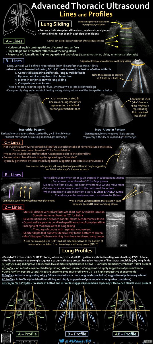 BrownJHM's tweet photo. Advanced thoracic ultrasound @MRamzyDO #POCUS #medtwitter https://t.co/CaqOsf3wxt