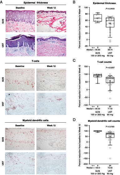 ImmunoHorizons's tweet photo. #NewinIH: James G. Kreuger & colleagues @RockefellerUniv @JanssenGlobal | #Guselkumab, selective #IL23 inhibitor, more effectively neutralizes #psoriasis-associated indicators than does Ustekinumab | #ReadIH #openaccess @ImmunologyAAI #societypublisher π https://t.co/Hae24W0bxr https://t.co/YkAzr0jZVs