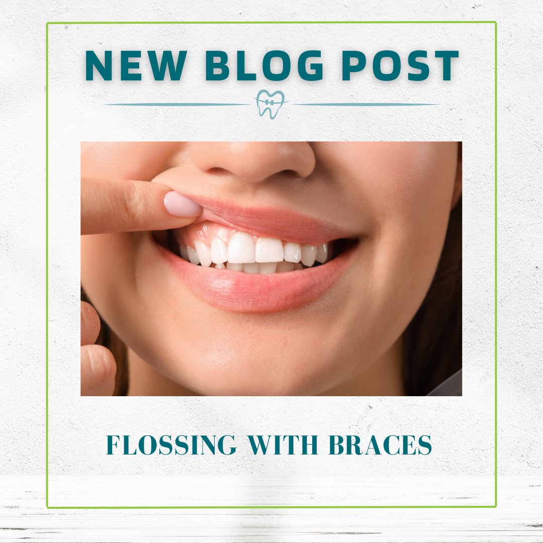 muenchortho's tweet photo. Flossing is an important part of oral hygiene, especially for people with braces. 👄

Read our latest blog to find out what two tools can help make flossing with braces easier and prevent plaque buildup and tooth decay. 🦷

https://t.co/pDvtRr3gJq

#MuenchOrthodontics #Blog https://t.co/n5U1F9p09Q