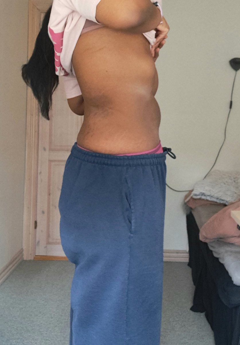 TheFatBunnee's tweet photo. My bf always mentions how small my waist has gotten from when he first met me. Sorry for always posting body checks even tho I'm still so fat lmao. 

BUT IM ALMOST OUT THE 180s(81.6kgs) I'm currently at like 182lbs(82.5kg) 
I really need to start working out again tho. https://t.co/mNzy5sBZgM