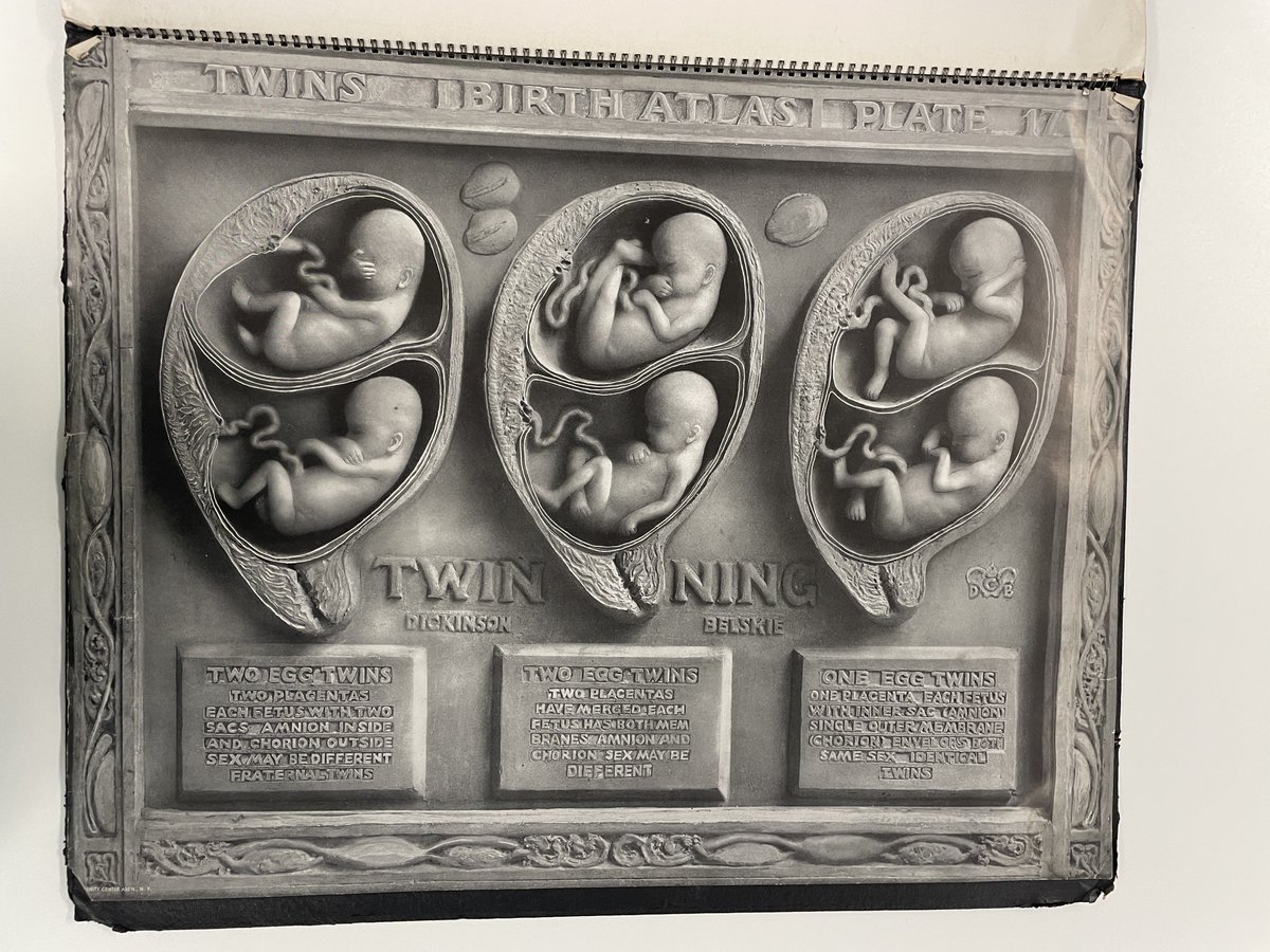 One example of #HealthArchives in our collections is this "Birth Atlas", given as a gift to nurse-midwives at the Queen's Institute of District Nursing from the Maternity Center Association in New York City. It's part of our Redwood College of Health archives #Archive30