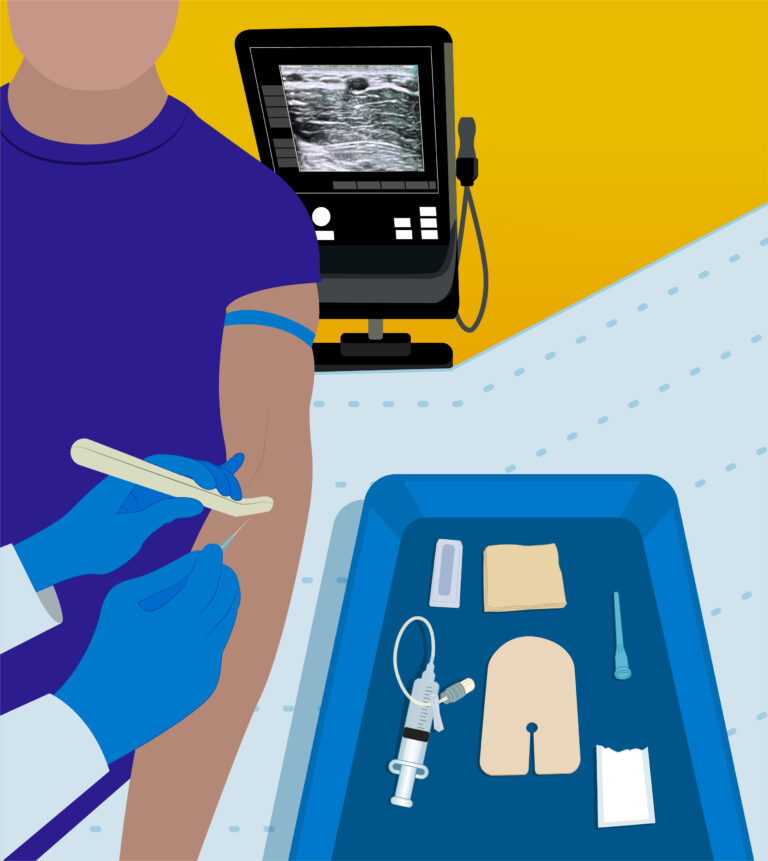 Want to improve your ultrasound-guided peripheral IV cannulation skills further? Here are some practical tips! 💉 Read more at ow.ly/E4Af50NIhM0 #dftb #foamed