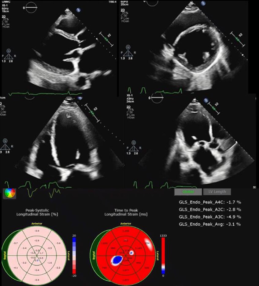JACC Journals tweet media