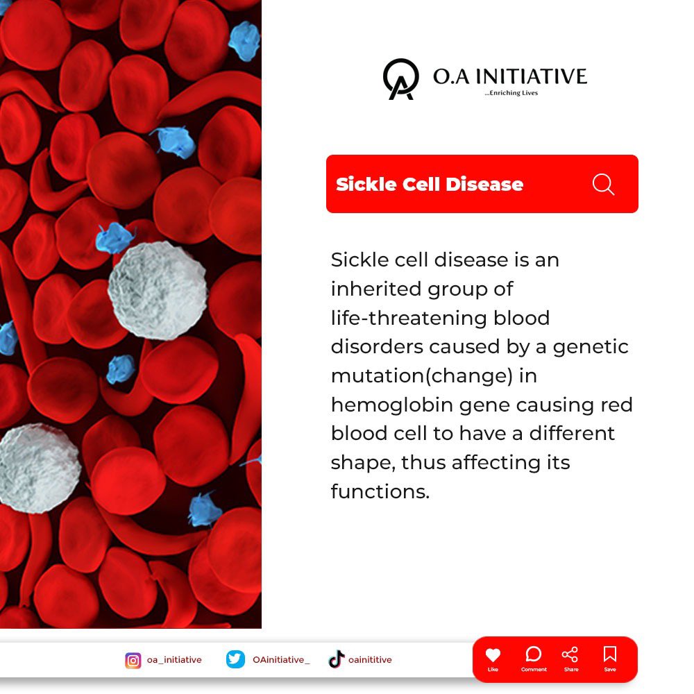 Day1

 What you need to know about Sickle Cell Disease 
Sickle cell disease is real and it is preventable 

#sicklecelldisease 
#SCD 
#PwSCD 
#sicklecelldiseaseawareness 
#sicklingselfie
