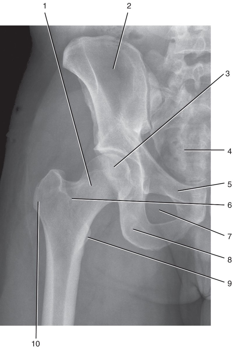 PasionAnatomia's tweet photo. #AnatomíaRadiológica de la #cadera⤵️📌
📌1 #CuelloDelFémur
📌2 #Ilion
📌3 #CabezaDelFémur
📌4 #Sacro
📌5 #Pubis
📌6 #LíneaIntertrocantérica
📌7 #AgujeroObturador
📌8 #Isquion
📌9 #TrocánterMenor
📌10 #TrocánterMayor

📚Gray. Anatomía básica, 2.ª edición, pág. 275. https://t.co/OiIXRyncTJ
