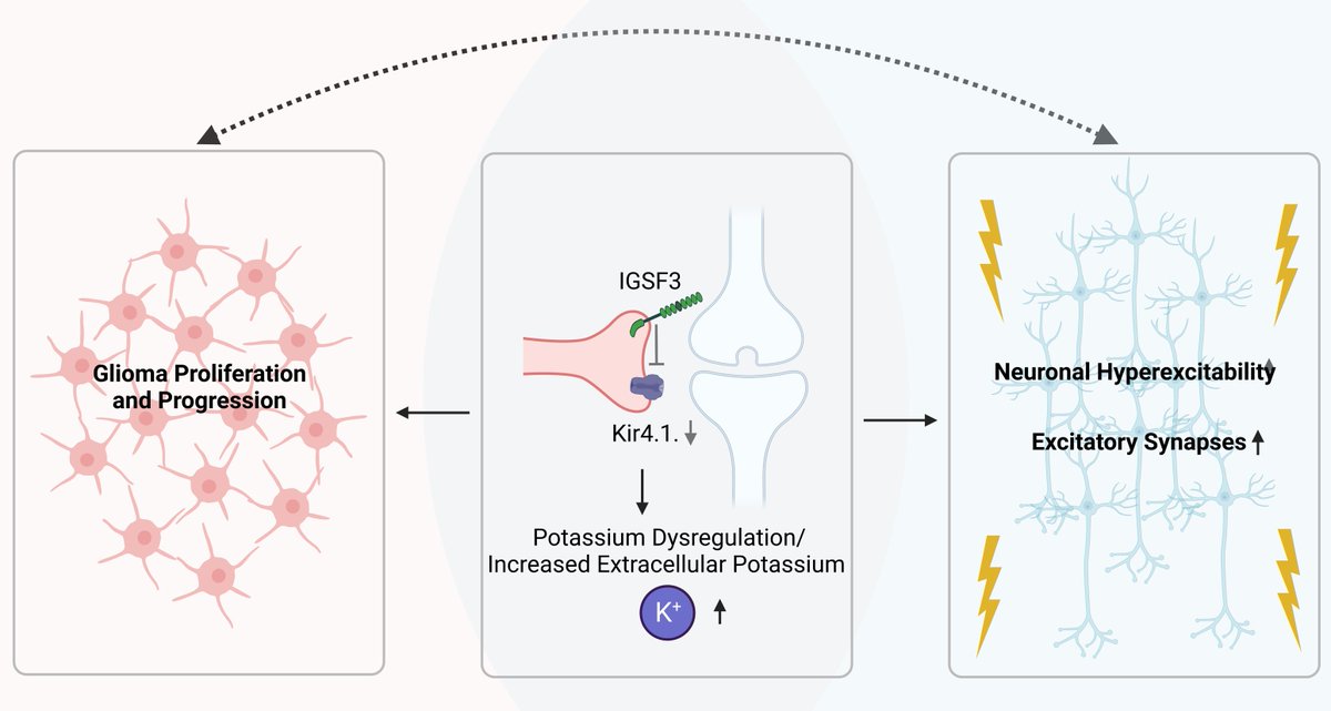 VarunVenkatara2's tweet photo. It was a pleasure to write a commentary (https://t.co/EcKxmQ4OY3) for @trendscancer about the recently published manuscript from Ben Deneen's lab in Neuron (https://t.co/EAfrMDYK7t) ! Exciting times to study neuron-tumor networks ! #CancerNeuroscience https://t.co/wBOZUiHkLM