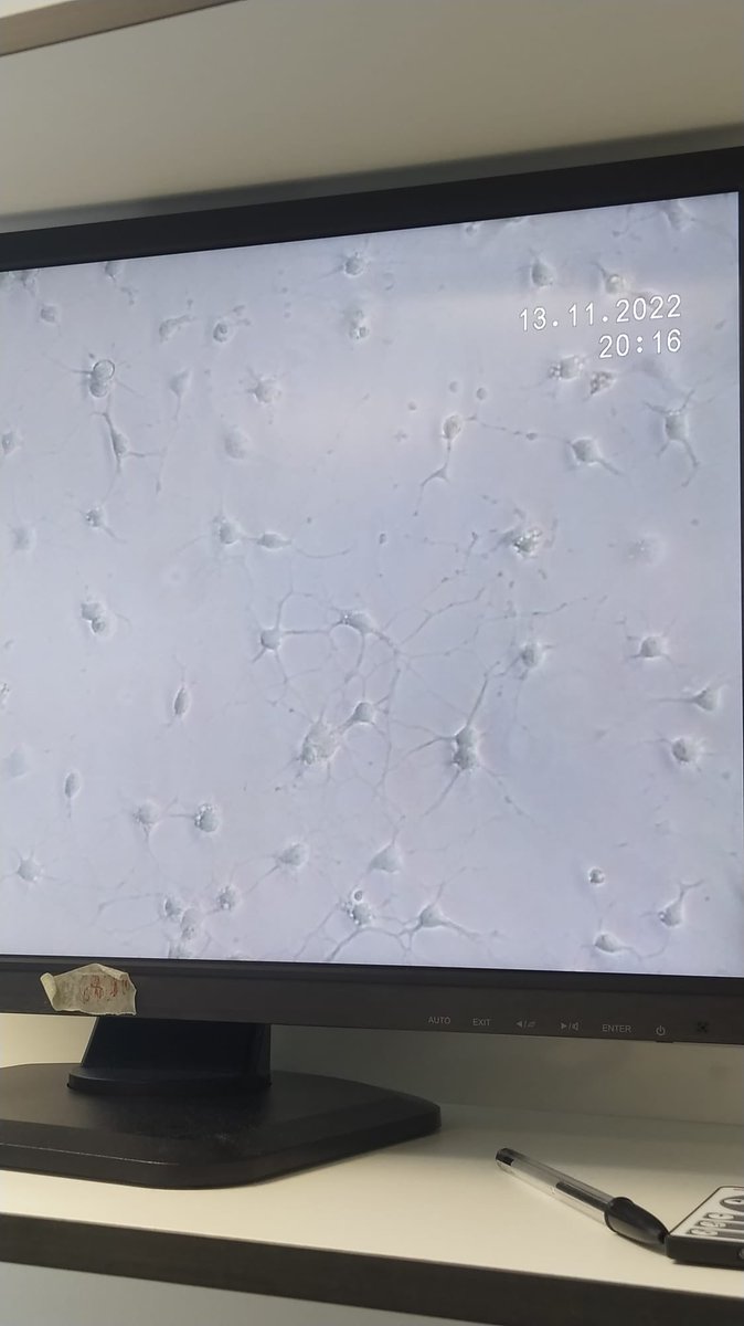 MyelinAlicante's tweet photo. Fantastic first experience abroad to have at the beginning of her scientific training for @SoniaCF_99 !! Learning new neuroimmunology models, meeting new colleagues and mentors, and expanding her scientific network with collaborations between @isabial_iis @NeuroAlc @WWIEM_QUB https://t.co/j9VksX7lKS