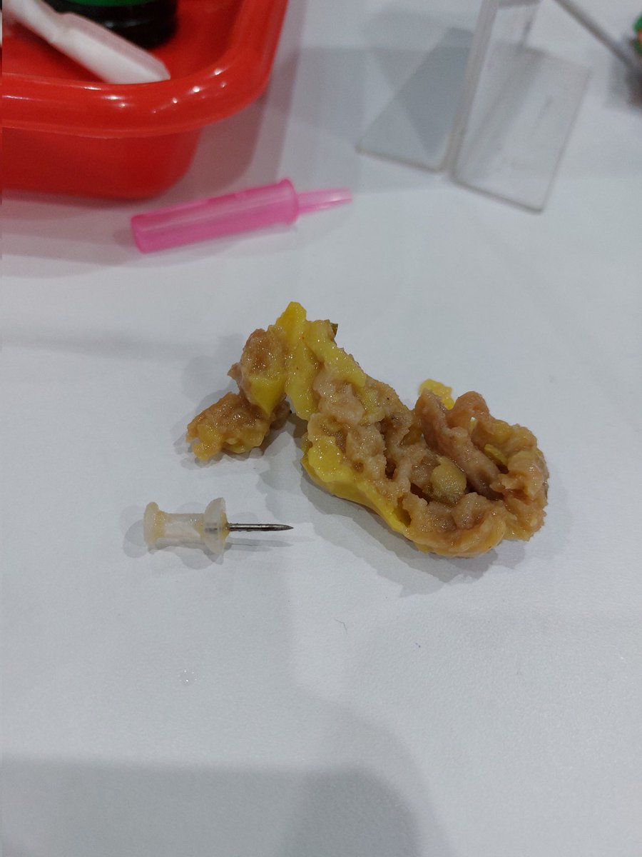 ramarambo19's tweet photo. serius ini PARAH &amp; FATAL BGT! Mo makan malah disuruh debus, kalian mo nyantet/melukain pelanggan?
📍 Hao Peng kopitiam. jl.Bali, Madiun.
EDAN, lnsg emosi &amp; ilfeel mo makan. Mana attitude pegawai²nya 👎🏼.
#kulinermadiun
#madiun #haopeng #kopitiam #madiunkuliner #kotamadiun https://t.co/FYvO5y99JH