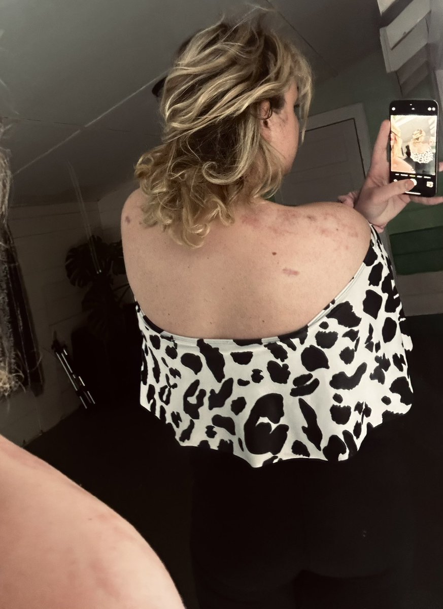 TussQueen's tweet photo. Who else wants to leave some marks on me? 🥰😈 #biting #rough #onlyfans #transonlyfans #transof #roughsex #kink #sub https://t.co/MyqzgYJ10z