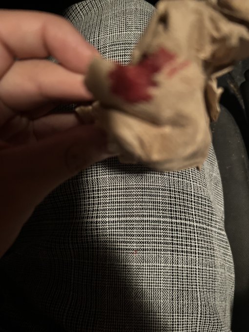 Currently bleeding from my nose. 🩸🩸🩸 why idk https://t.co/tb7w0wJbQk<a href="/tag/kawaii"class="tags"><span>#kawaii</span></a><a href="/tag/hellokitty"class="tags"><span>#hellokitty</span></a><a href="/tag/journal"class="tags"><span>#journal</span></a><a href="/tag/stationery"class="tags"><span>#stationery</span></a><a href="/tag/sario"class="tags"><span>#sario</span></a>