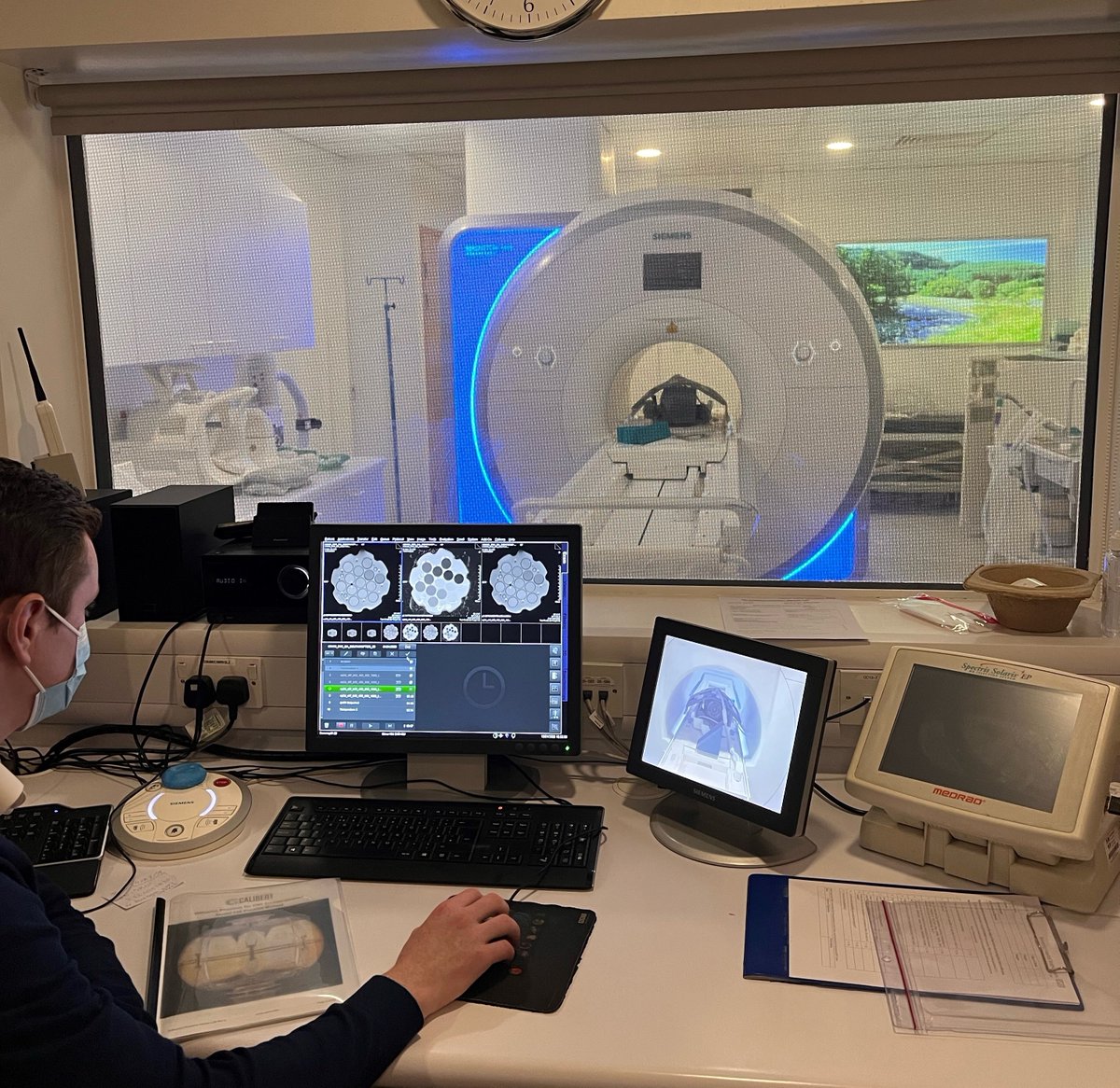 SouthamptonCTU's tweet photo. Test runs of a specialist imaging technique have been taking place at hospitals running the CRAIN #CervicalCancer trial.
This ensures standardisation of a #research imaging sequence in the biomarker arm of the trial, giving us extra information about how the treatment works. https://t.co/7GHs6U1Ipg