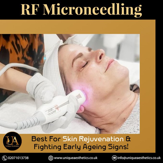 ExclusiveAawb's tweet photo. Itβs RF Microneedling Time Baby!! Get Your Skin Glowing With The Benefits Of LED lights Emitting Radiofrequency! Hurry Book Your Treatment Now!!
#londonmarathon2023 #emergencyalertuk #EmergencyAlert #ImACeleb #London #beauty #BeautyMyWay #GLOW #skincare #TuesdayFeeling https://t.co/sPXRb3MinO