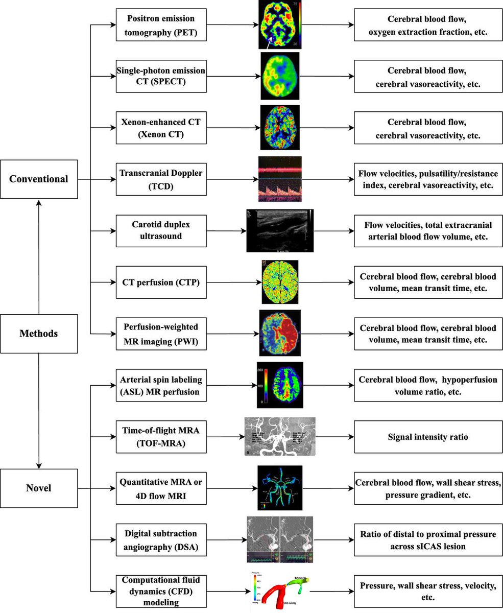 SVN_CSA's tweet photo. Cerebral haemodynamics in symptomatic intracranial atherosclerotic disease: a narrative review of the assessment methods and clinical implications @CUHKMedicine @CUHKofficial @dliebesk #ICAS #sICAD https://t.co/77Ja0uT1zO
