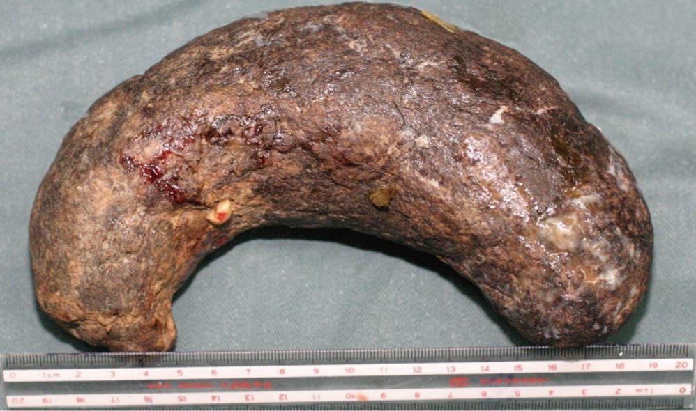 Keith Siau tweet media