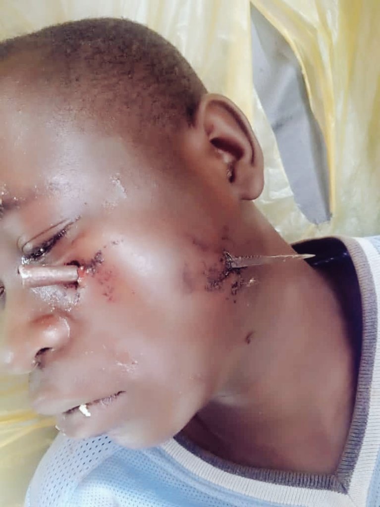 PetersonKilama's tweet photo. We qre unceasingly and relentlessly not giving up until actions are taken against the current situations of Northern Uganda in the district of Abim ,Lamwo,Kitgum caused by Karamojongs who are killing, raiding our animals, burning our homes . 
#NorthernDeathExhibition https://t.co/Ns3e9TnTSX
