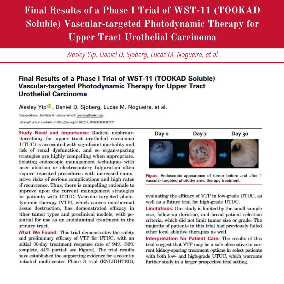 Final Results of a Phase I Trial of WST-11 (TOOKAD Soluble) Vascular-targeted Photodynamic Therapy for Upper Tract Urothelial Carcinoma auajournals.org/doi/10.1097/JU…