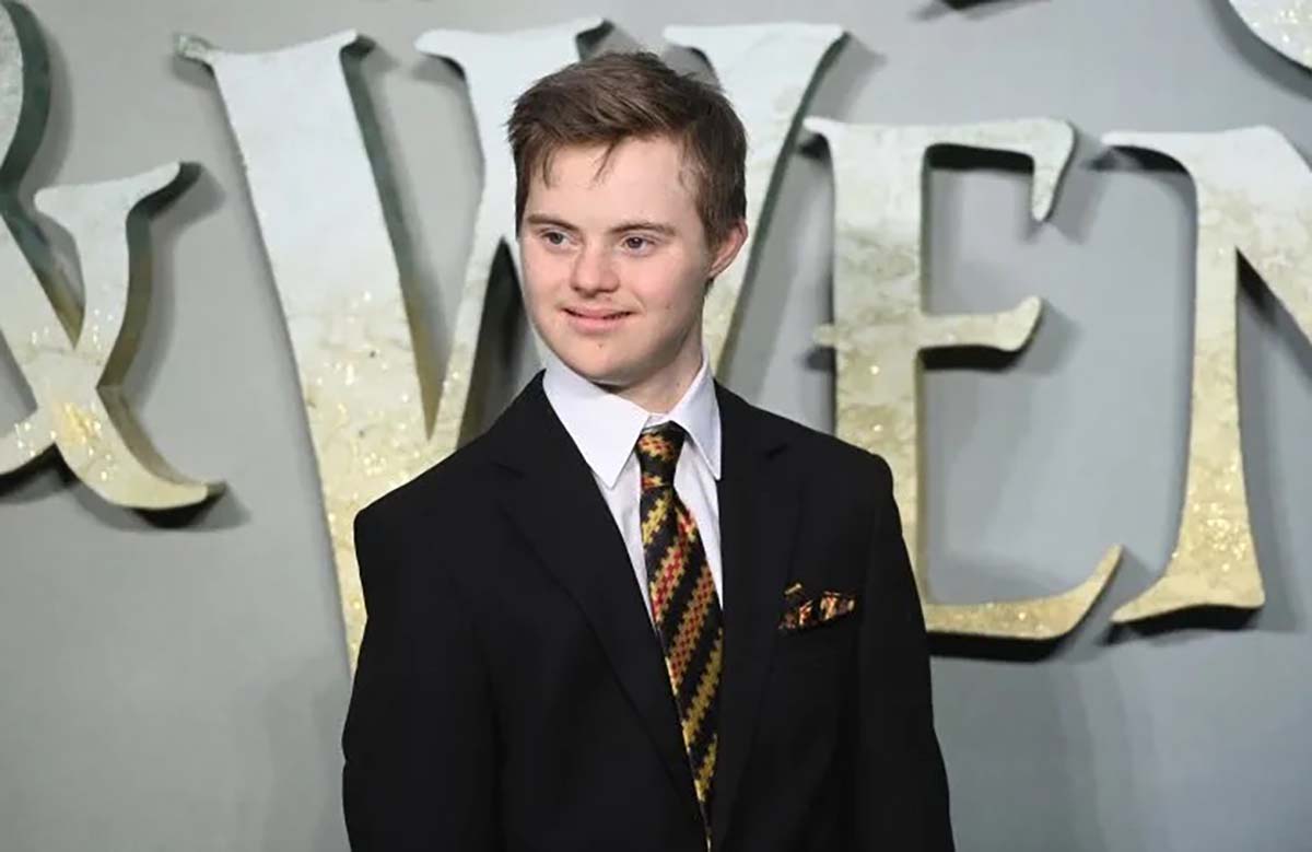 creapills's tweet photo. Pour la première fois, Disney attribue un rôle majeur à un acteur atteint de trisomie 21. À 15 ans, Noah Matthews Matofsky incarnera un personnage clé dans le film “Peter Pan &amp; Wendy” qui sortira le 28 avril prochain

Plus d’infos : https://t.co/vGsHLPV64L https://t.co/UPfLwHqgFv