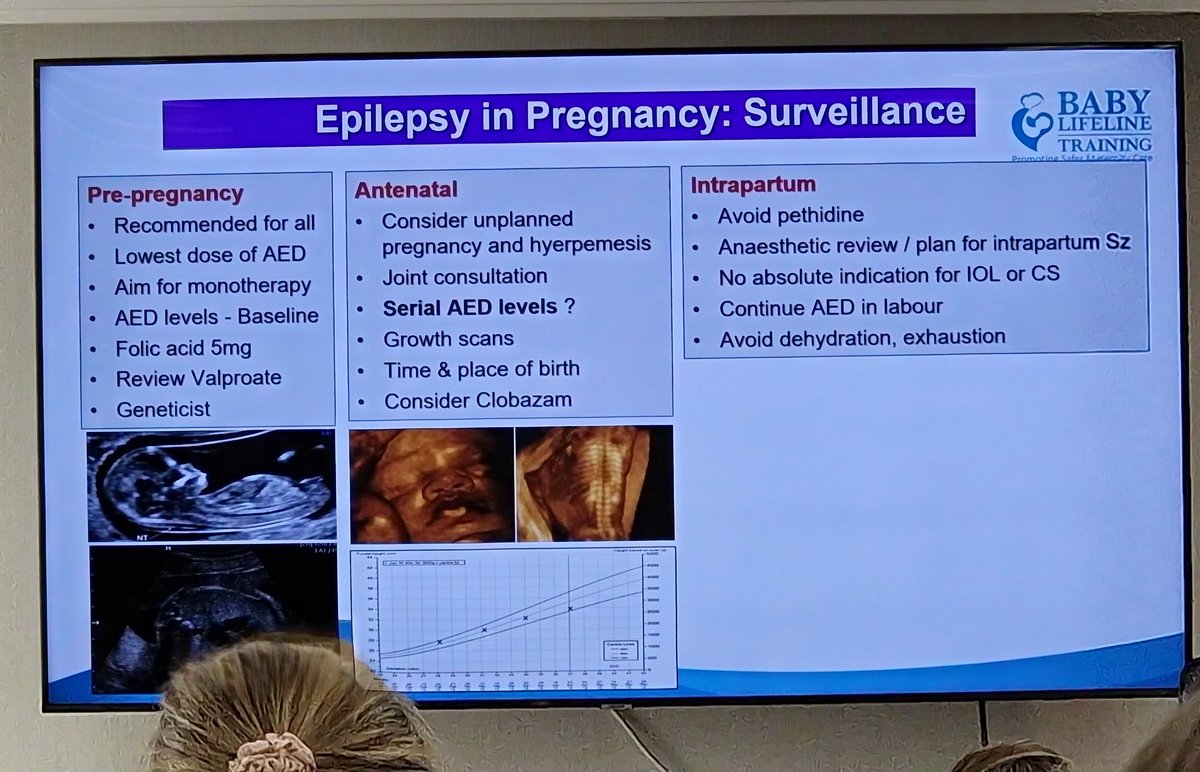 Good practice in epilepsy management in pregnancy <a href="/BabyLLTraining/">Baby Lifeline Training 💙</a>