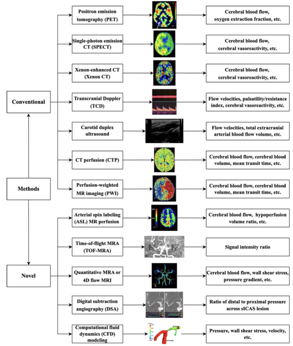 AshuPJadhav's tweet photo. Cerebral haemodynamics in symptomatic intracranial atherosclerotic disease: a narrative review of the assessment methods and clinical implications  https://t.co/3kxxASRngs https://t.co/3ugwbBaCFH