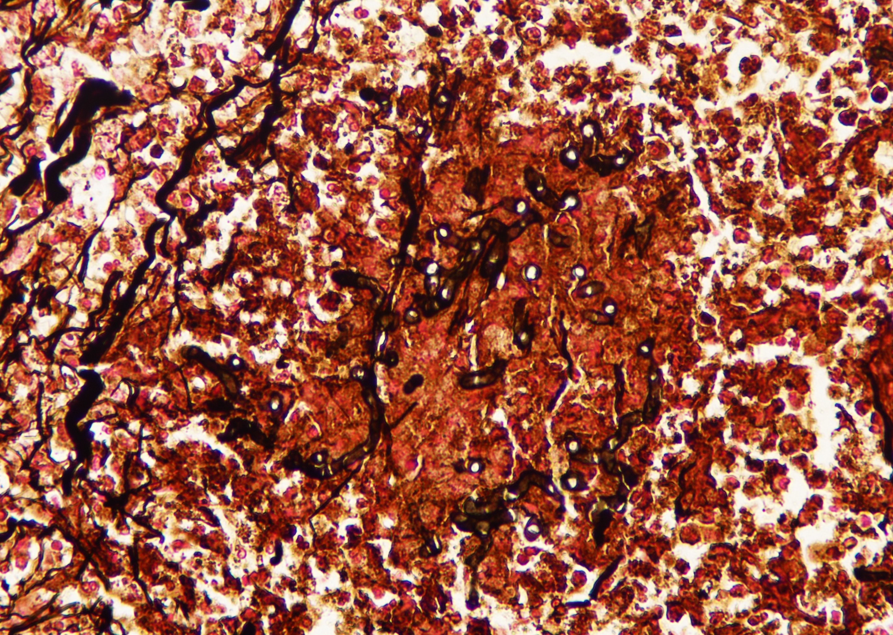 Ashok Parameswaran (ashokparameswar) / Twitter