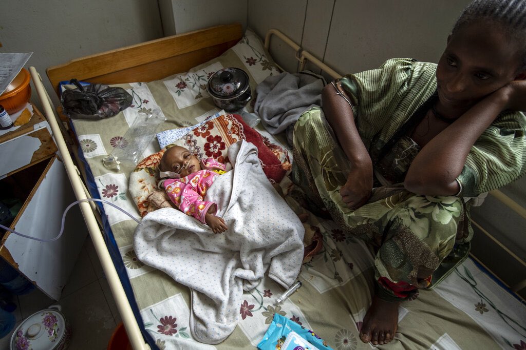 A woman sits with her underweight 17 month old baby. The lone survivor of her triplets, the infant was admitted with complications stemming from severe acute malnutrition, including heart failure. #StopTigrayFamine It's time for the @UN to act NOW.@WHO @WFP @DrTedros