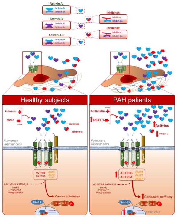 Montanidavid's tweet image. Congratulations @GuignabertLab on this outstanding study published in Circulation. New insights into the activin signaling system and identification of new biomarkers (activin A and FSTL3) in #PAH  @AthenaisBoucly @SavaleL  @InsermU999 @pulmotension   ahajournals.org/doi/abs/10.116…