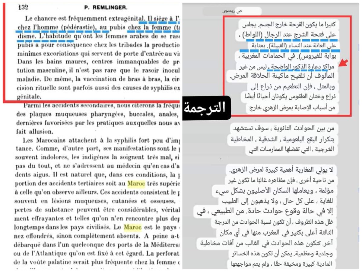 NsOuDjMst_27dz's tweet photo. من بين الأمراض الشائعة أيام الحماية الفرنسية 🇫🇷 في المروك 🇲🇦#الأمراض_التناسلية، وأعتبر مرض #الزهري مرضا مغربيا بإمتياز ، بسبب الدع*ارة ونجم عنه قرحة داخل 🔞 لدى الرجال(اللو،،اط) وقرحة ف🔞 لدى النساء. مرض #السيلان وأيضا أمراض لجهاز البولي التناسلي #ترحيل_المغربيات_مطلب https://t.co/hcCMMq9Fu6