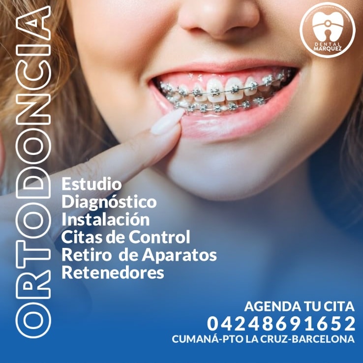 laradioveguera: #DentalMarquez
Contactarnos para que descubras nuestros planes de financiamiento a tu alcance 
#Cumana 
#Barcelona 
#PtoLaCruz 
#ortodoncia