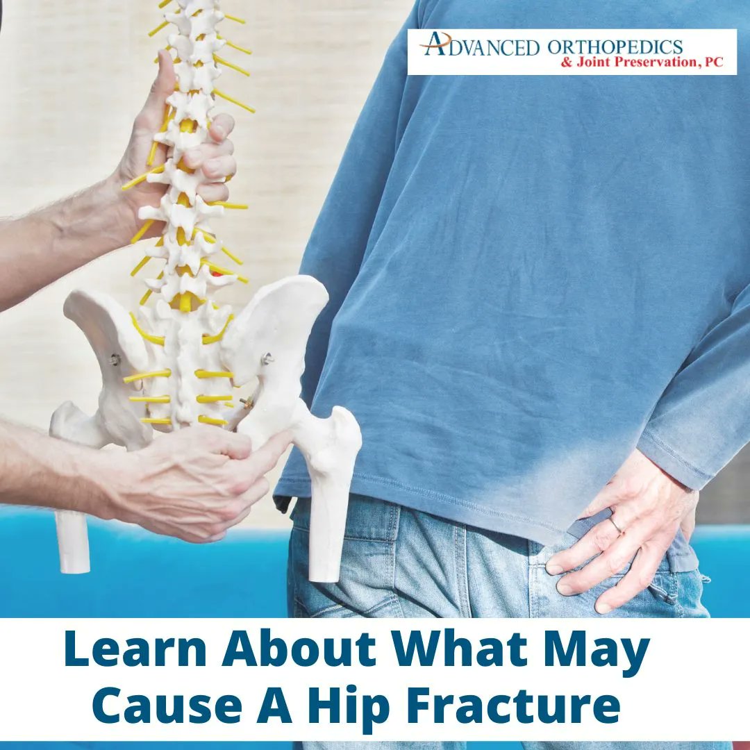 AdvancedOrthoNY's tweet photo. A hip fracture can be a serious injury, often caused by trauma, falls, or weakened bones due to osteoporosis. It's important to take steps to prevent falls by improving balance and strength through exercise. 

https://t.co/KWURCpWU1R

#ValleyStream #Brooklyn https://t.co/s8s0MqVCEG