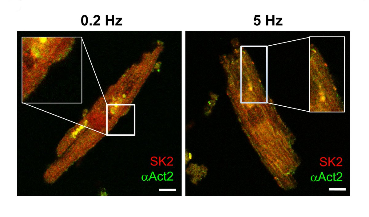Heijman,et al found that #SK current is increased in #AFib patients due to rapid rate-dependent channel trafficking &amp; gating mechanisms. Learn more about a potential novel mechanism for self-promotion of AFib at ahajournals.org/doi/10.1161/CI…

<a href="/JordiHeijman/">Jordi Heijman</a> <a href="/StanleyNattel/">Stanley Nattel</a>