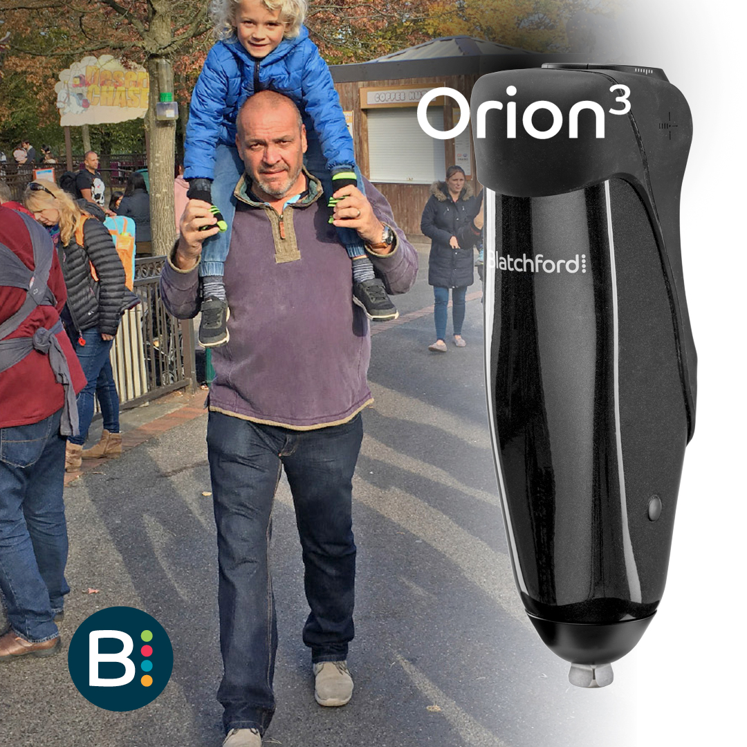 BlatchfordGrp's tweet photo. “I am more confident and more willing to try things that I may have been unsure about before.” – Duncan, Orion3 wearer https://t.co/8ovUMBCco0
#BlatchfordOrion3 #Orion #orion3 #prostheticknee #prosthetic #prosthetics #prostheticlimb #prostheses #MPK #bionicleg #bionicknee https://t.co/sqZkHn96YN