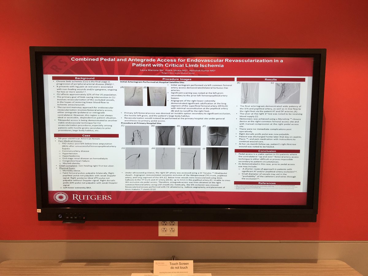 RutgersIR's tweet photo. Fantastic job by @Rutgers_NJMS medical students at the First Annual Research Symposium! #futureirads @SIRRFS https://t.co/xLQIXaiUDc
