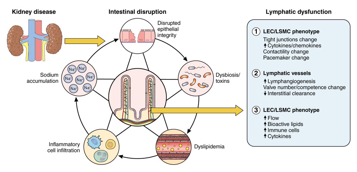 @CircRes Review Alert! #Intestinal #Lymphatic Dysfunction in #KidneyDisease. Learn more at ahajournals.org/doi/10.1161/CI… @Jianyong_zhong @N/A @annetkiraboc1 @AgnesFogo