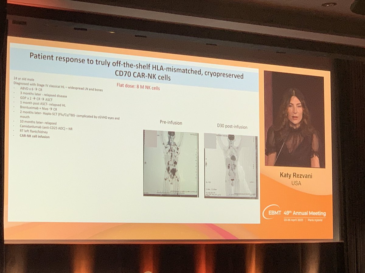 May Daher (@may_daher) on Twitter photo Mesmerizing talk by <a href="/lab_rezvani/">Katy Rezvani, M.D., Ph.D</a> at #EBMT2023 showcasing the multiple NK engineering platforms to enhance NK anti-tumor activity, with new exciting and promising early clinical data of CD70 targeting CAR-NK cells! #NK #CAR #celltherapy Mesmerizing talk by <a href="/lab_rezvani/">Katy Rezvani, M.D., Ph.D</a> at #EBMT2023 showcasing the multiple NK engineering platforms to enhance NK anti-tumor activity, with new exciting and promising early clinical data of CD70 targeting CAR-NK cells! #NK #CAR #celltherapy