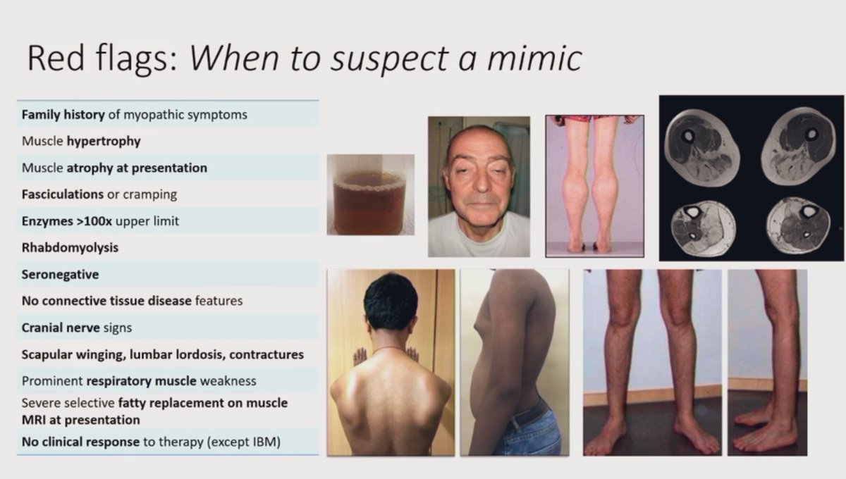 #myositis mimics / red flags 🚩 

#BSR23