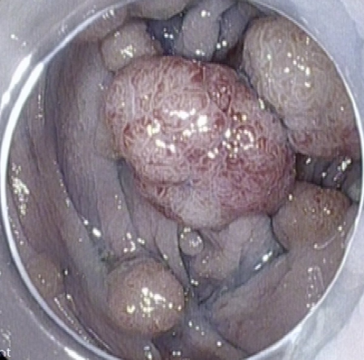 Keith Siau tweet media