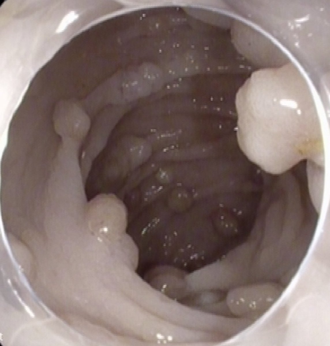 Keith Siau tweet media