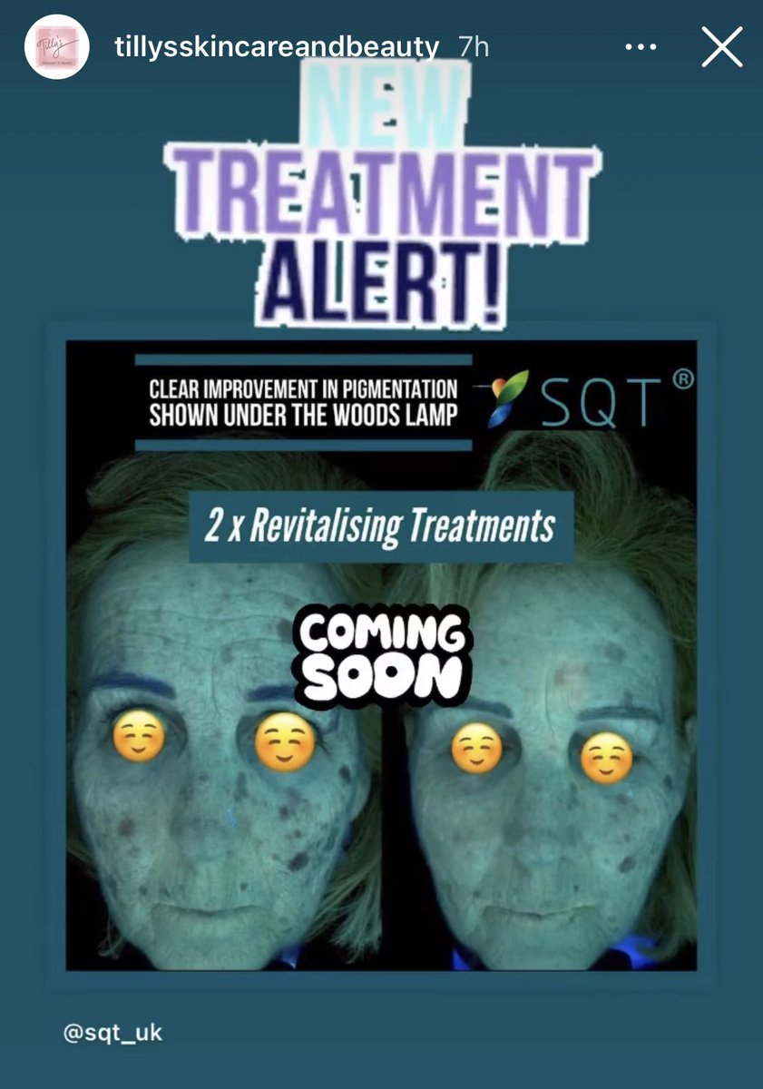 NEW TREATMENT COMING SOON