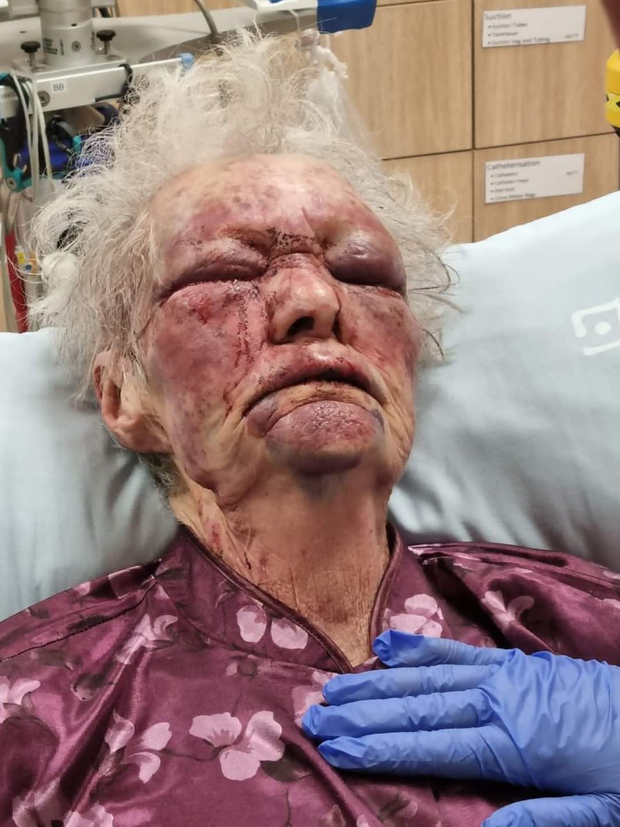 Edenburg Police are searching for a suspect who allegedly broke into an elderly woman’s house in town on 23 April 2023, assaulted her and fled. Anyone with info to contact Capt Jolinga on 0824676324.