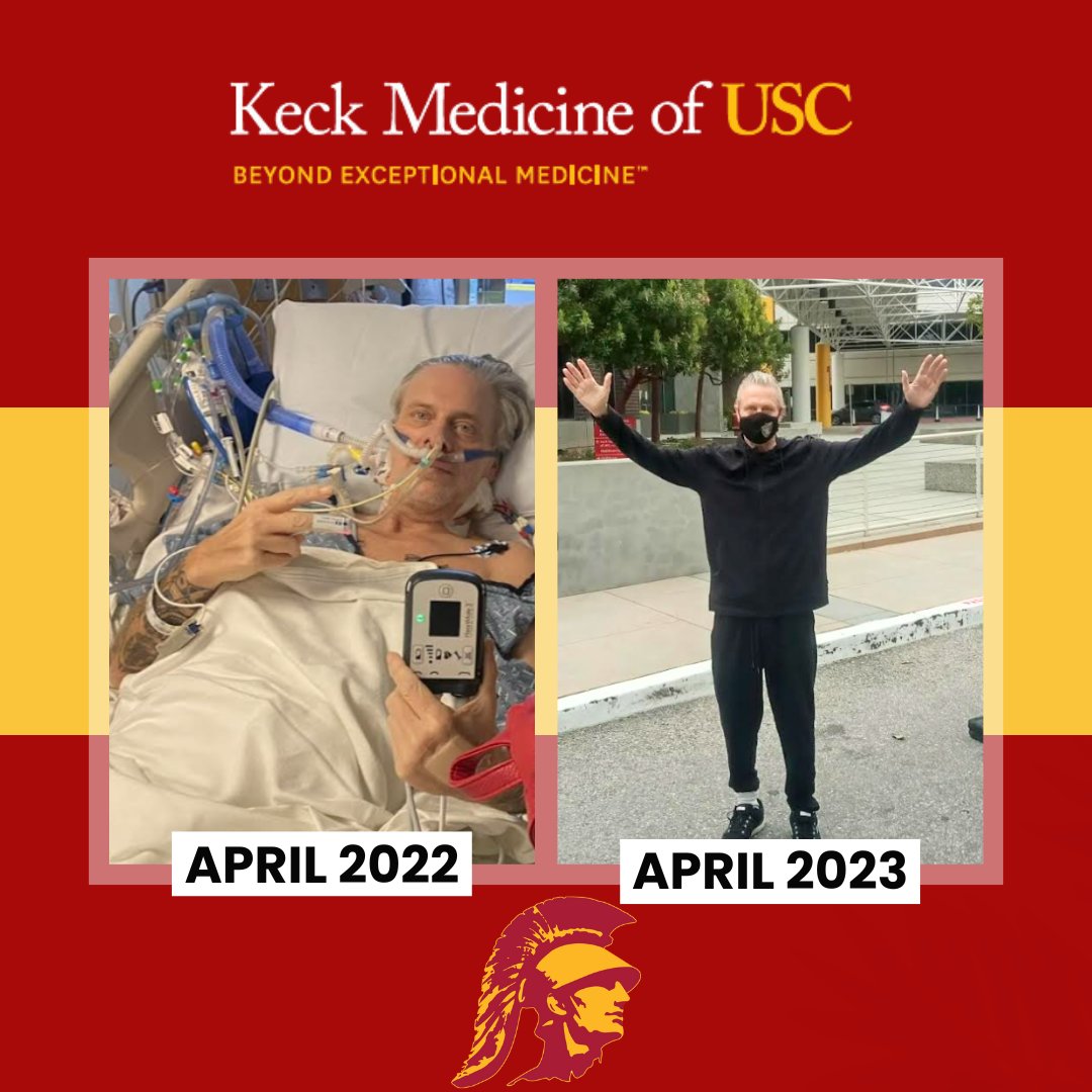 ALOT CAN HAPPEN IN ONE YEAR! From BTT LVAD to Heart Transplant this patient is a constant reminder to #FightOn!
